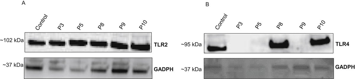 New article in press: Inflammation and joint destruction may be linked to the generation of cartilage metabolites of ADAMTS-5 through activation of toll-like receptors
ow.ly/TMrA50xdAka
#osteoarthritis