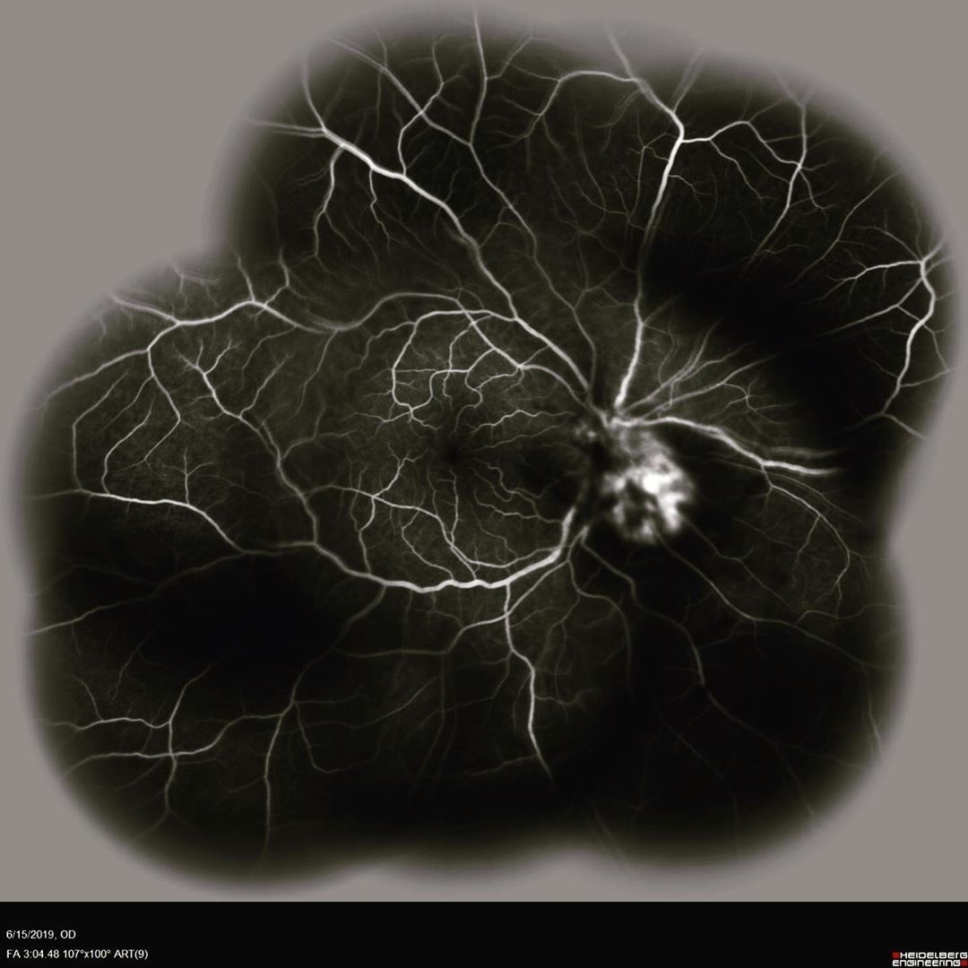 CENTERVUE tweet media