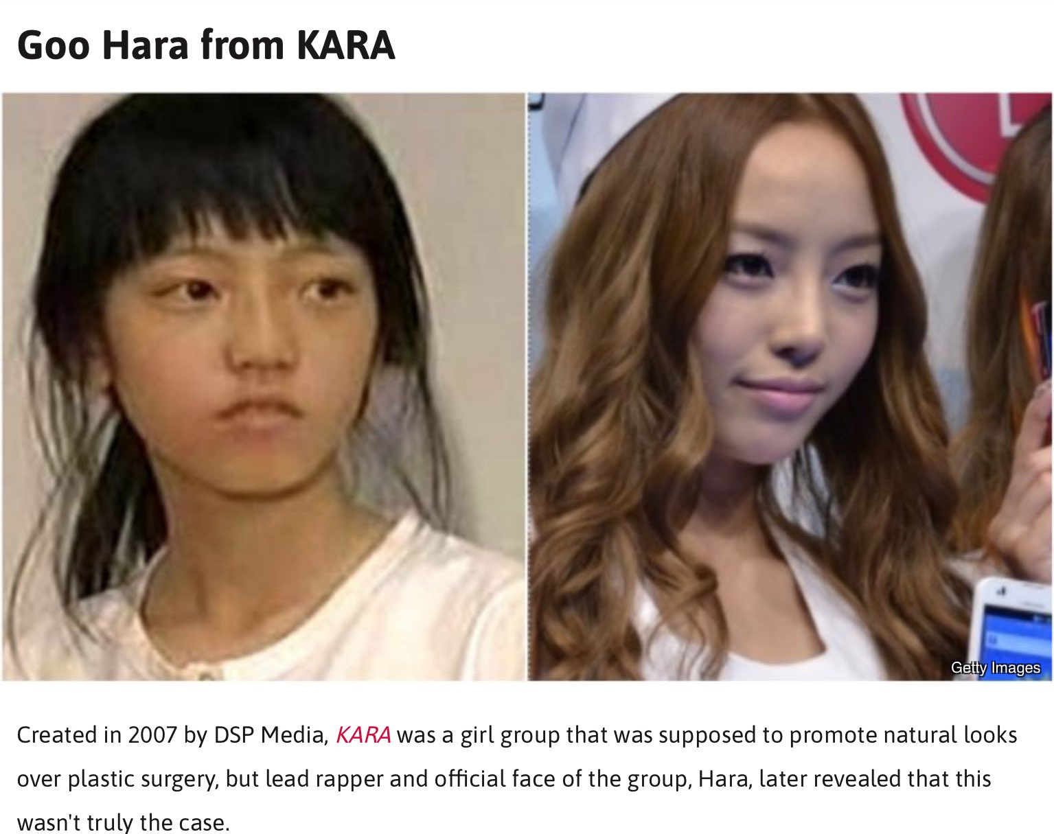 Kpop Plastic Surgery
