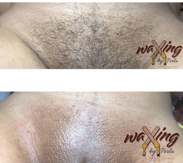 waxingbyperla's tweet photo. Somebody say wax ? Brazilian π₯π£
#waxingbyperla #waxinglife #skincare #goodresults #fastwaxers #teamwax #brazilianwaxpro #brazilianwax #vaginawax #waxingpr #waxaddict #waxpro #waxartist #nohair #clean #profesional #costumer #happycustomer #exfoliate #scrubskin #loofa #bodyscrub https://t.co/VHn375sbHO