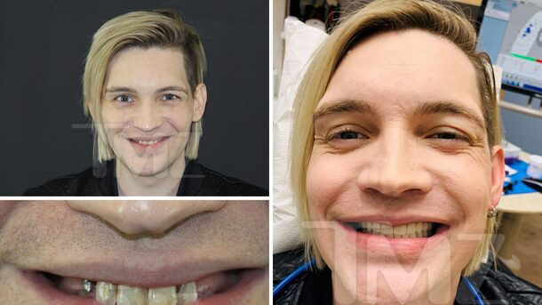 Patrici90883364's tweet photo. The Calling Singer Alex Band Gets New Teeth and It's Gnarly via @TMZ https://t.co/DkzibfF3eh https://t.co/2X4gglJ2Kz