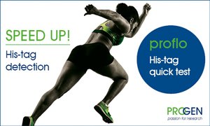 Progen_Biotech's tweet image. NEW! proflo His-tag quick test - Speed up #His-tag #protein #detection with the new proflo His-tag quick test. The #immunochromatographic #latral #flow #assay allows quick &amp;amp; easy monitoring of His-tag proteins during #expression, scale up &amp;amp; #purification. mailchi.mp/progen.com/pro…