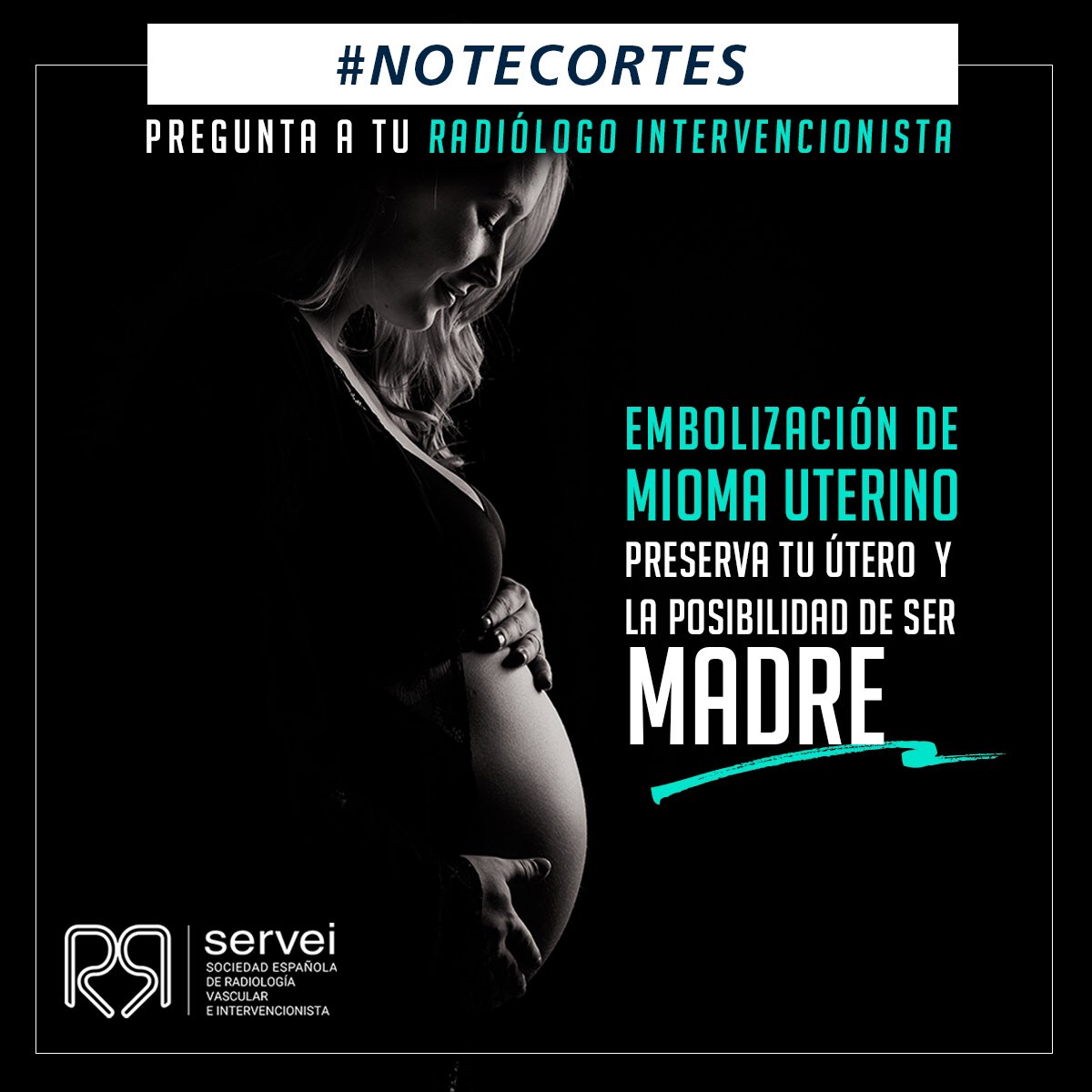Guiro_IRad's tweet photo. #notecortes todas las mujeres que padecen de miomas o fibromas uterinos deberían de saber la posibilidad de la #embolización uterina. Preserva tanto el utero como la posibilidad de futuros embarazos. @SERVEISoc @RevIntervenc @cirsesociety #gitmi https://t.co/jmhLypjYDu