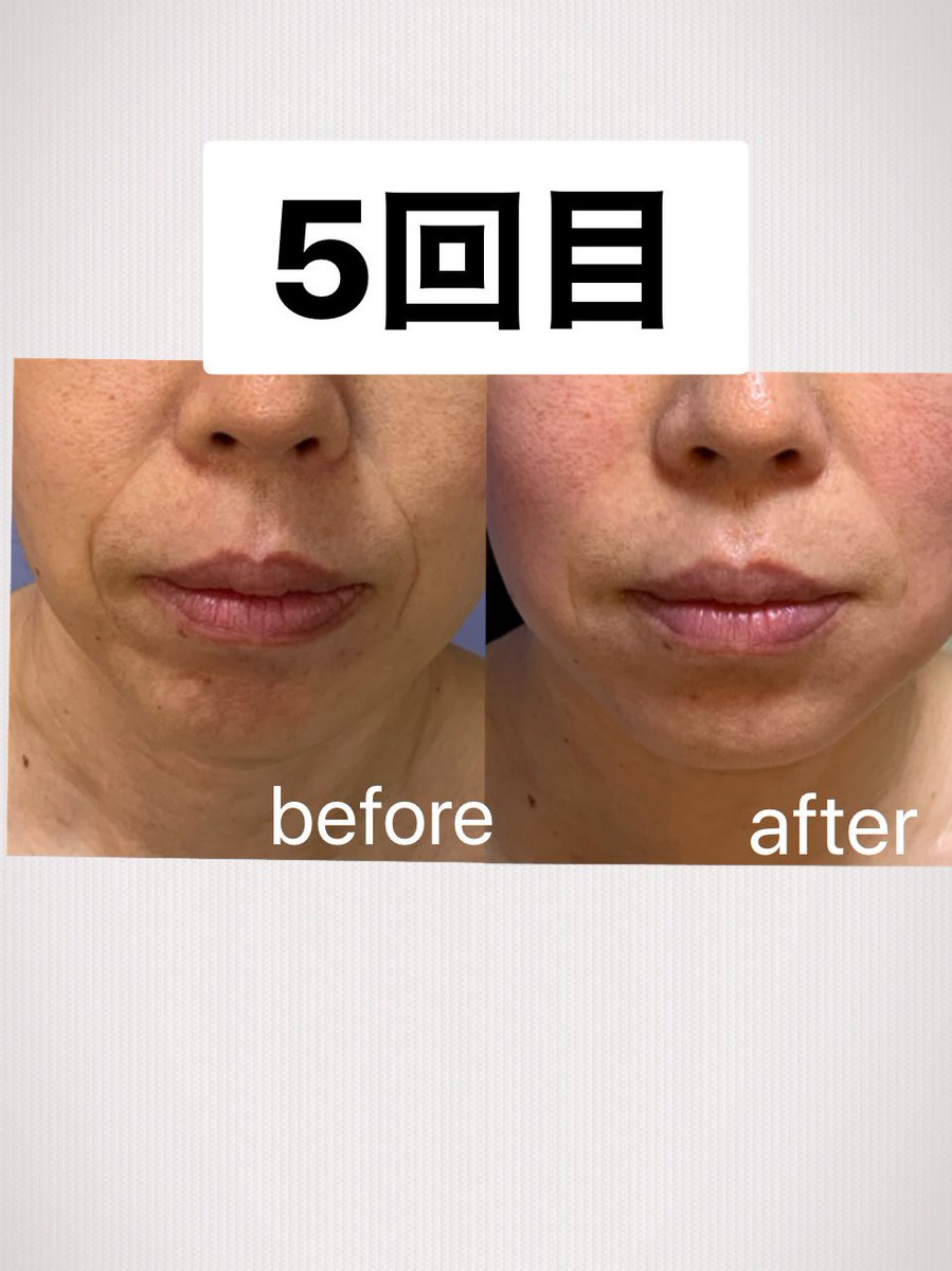 美骨気lino Lino Twitter