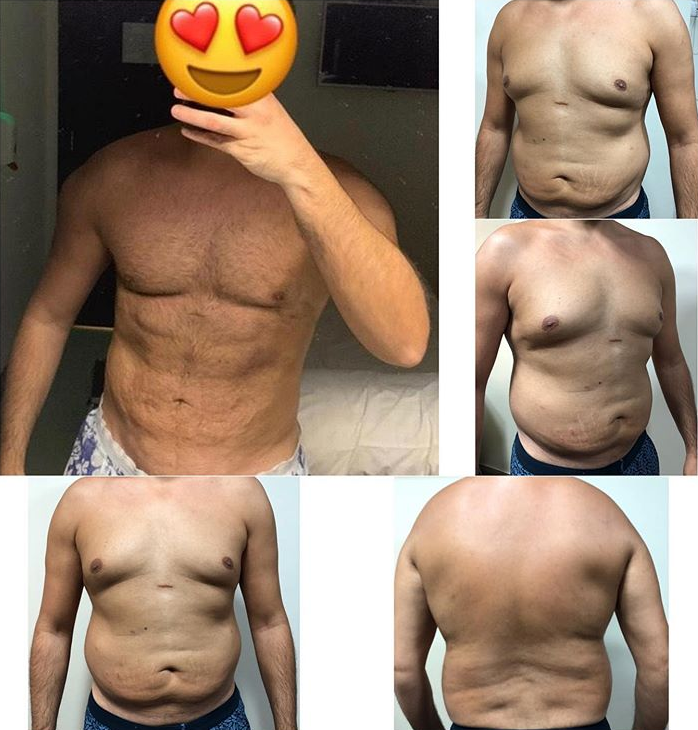 TahseenClinic's tweet photo. دايما فخور بيك و بعزيمتك صديقى العزيز الجميل ❤️ ❤️ Always proud of you 💪

#tahseen4d #DrHossamTahseen #totaldefiner #tahseen4d_physique #bodybuilding #fitness #دكتور_حسام_تحسين #تحسين_شدالجلد #model #muscle #physique #tahseen_makeover #نحت_الجسم https://t.co/y5uw4SJNQo