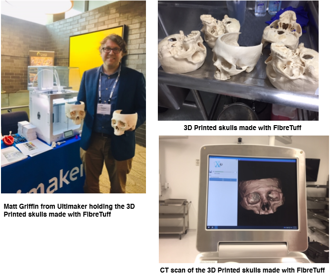 Detroit3DHEALS1's tweet photo. From our neighbor in Ohio- FibreTuff
A Craniomaxillofacial event attended by over 50 surgeons, got the chance to work with 3D Printed anatomical ”bone like” skulls models made with FibreTuff and printed on the Ultimaker S5. @3dheals @Ultimaker
@DelraySystems #modl3d #Detroit https://t.co/JHloyemDdW