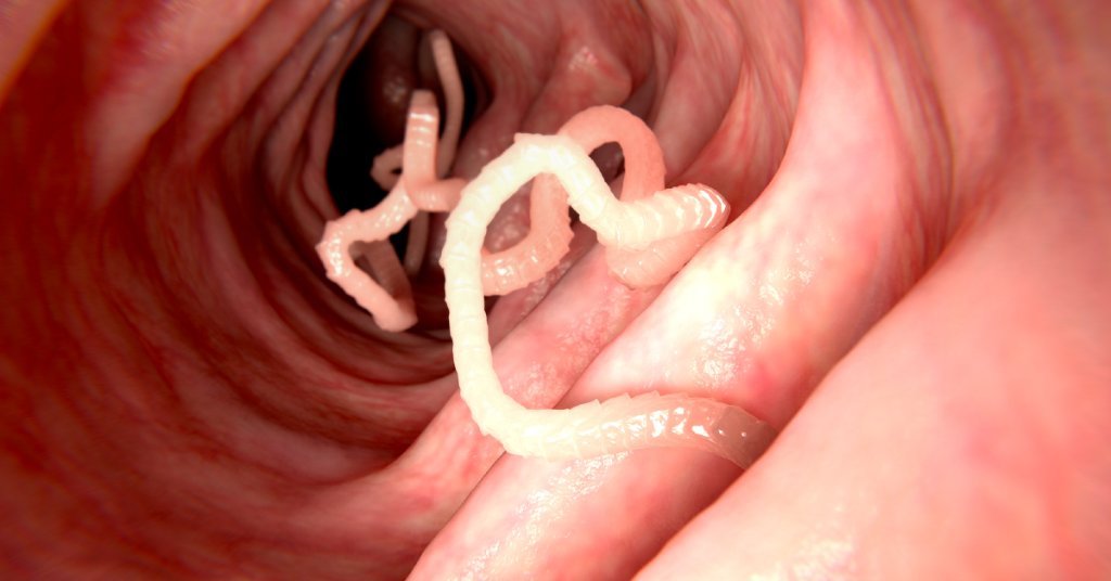 تويتر Webmd على تويتر It S Rare For People To Get A Tapeworm From Animals But It Can Happen Typically Your Pet Swallows An Infected Flea And Then You Swallow A Flea