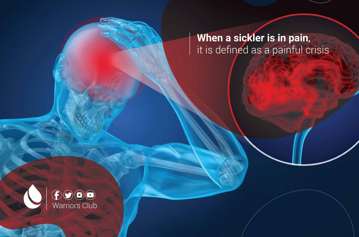 Pain crises are recurrent episodes of pain that range in severity from mild to severe, usually occur very abruptly and are often localized around joints. #Sicklecellpain #Painfulcrisis #Sicklecelldisease