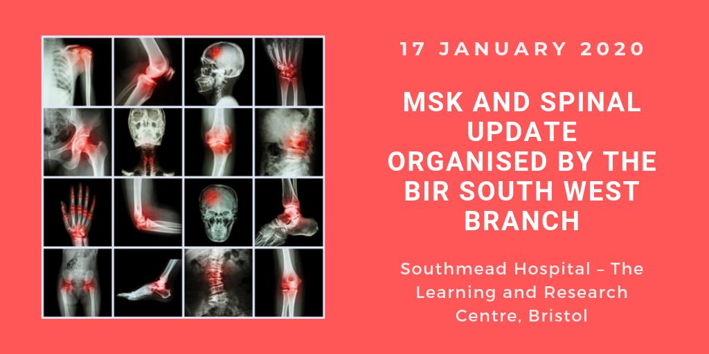 BIR_News's tweet photo. Want to find out more about Spondyloarthropathy and the imaging of various stages? Register now for the #MSK and #spinalupdate event organised by the #BIR South West Branch! https://t.co/WabRl17bXl https://t.co/5GSMbzyXq4