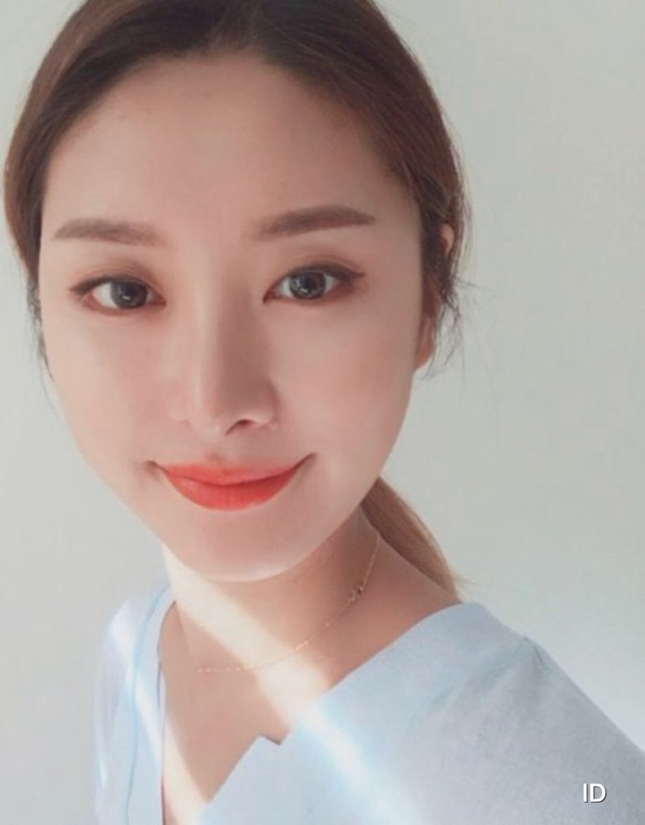 韓国美容観光エージェンシーharu より美しく より魅力的になりたい方 日本人モニターも大変身した病院で イメチェンしてみませんか 両顎手術 Vライン手術 鼻整形 Haruのブログ T Co 5ric7ap19s Haruでは写真による簡単な 韓国美容観光エージェンシーharu より美しく より魅力的になりたい方 日本人モニターも大変身した病院で イメチェンしてみませんか 両顎手術 Vライン手術 鼻整形 Haruのブログ T Co 5ric7ap19s Haruでは写真による簡単な