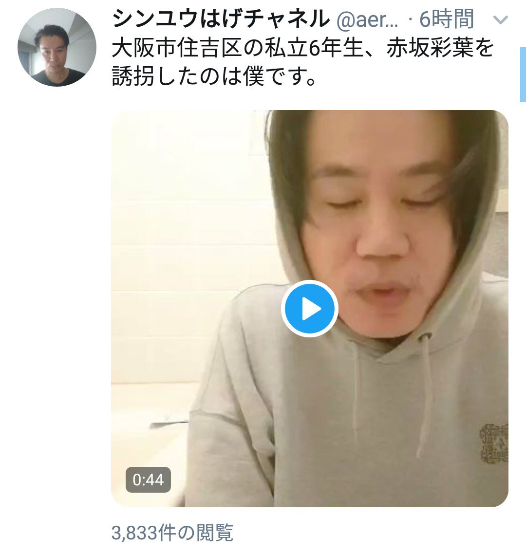 チャネル シンユウ はげ