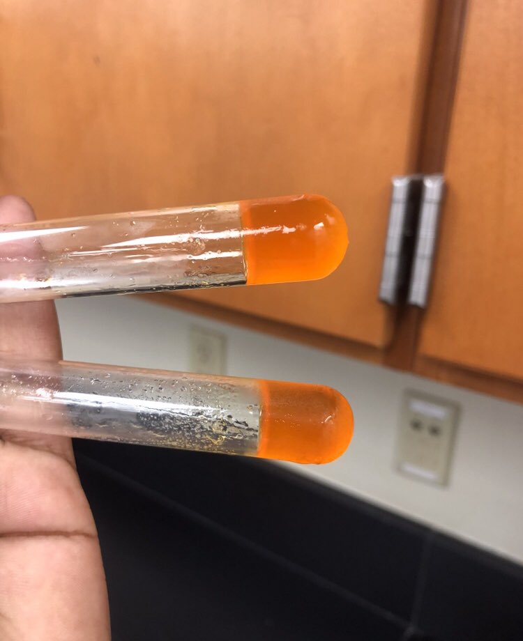 Vanessa33313us's tweet photo. #BCcellchemlab #cellchem #Showmetheprotien #supersugar #fatsarefun https://t.co/OGmNKWFSj0