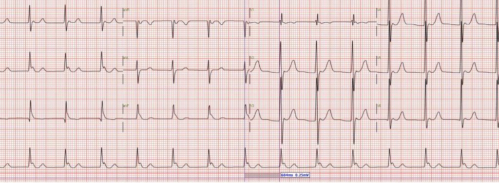 Eric Lim tweet media