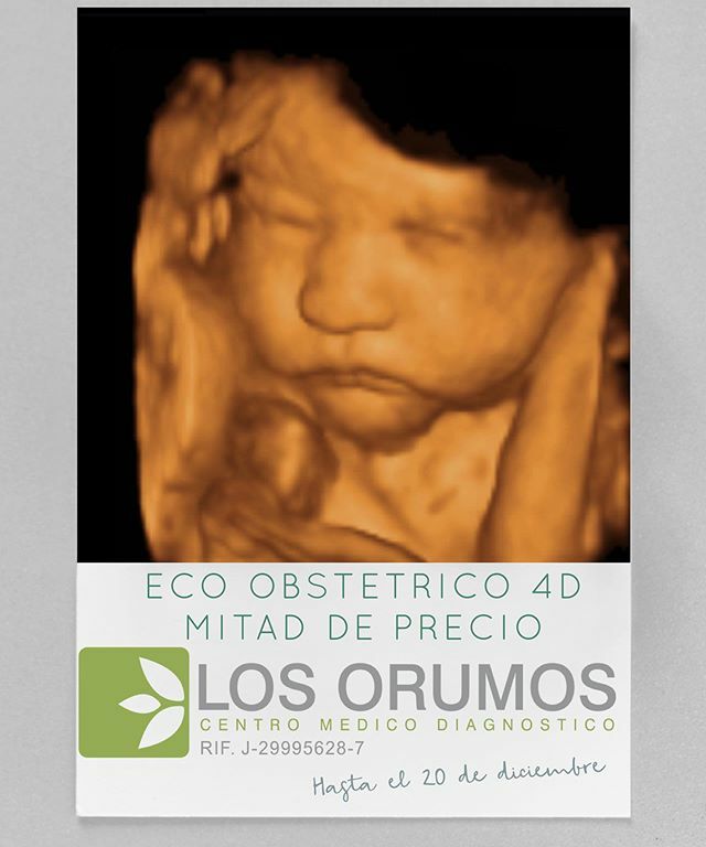 cmdlosorumos's tweet photo. Ecograma Obstétrico 3D (foto) y 4D (video) Para mayor información al Whatsapp +58 4120651686 https://t.co/eZqeEeGHtW