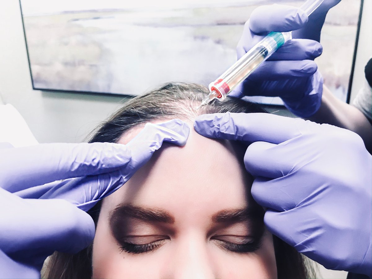 moddermatology's tweet photo. Are you experiencing hair loss or thinning? You’re not alone. We're here for you. 💜

PRP Therapy could be what you’ve been looking for! This treatment is specific to YOU. PRP triggers natural hair growth and maintains it by increasing the blood supply in your hair follicle. https://t.co/lxENYRojyv