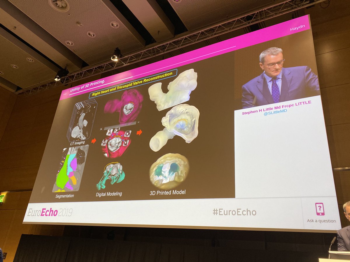 Akhil Narang, MD (@akhilnarangmd) on Twitter photo Lots of amazing sessions today at #EuroEcho - from fusion imaging (Dr. Faletra) to artificial intelligence and automated quantification in #EchoFirst (<a href="/lpbadano/">Luigi</a>) to the advancements in 3D printing (<a href="/SLittleMD/">Stephen Little, MD</a>) to virtual reality (<a href="/robertomlang/">Roberto M Lang</a>)...the future is exciting. Lots of amazing sessions today at #EuroEcho - from fusion imaging (Dr. Faletra) to artificial intelligence and automated quantification in #EchoFirst (<a href="/lpbadano/">Luigi</a>) to the advancements in 3D printing (<a href="/SLittleMD/">Stephen Little, MD</a>) to virtual reality (<a href="/robertomlang/">Roberto M Lang</a>)...the future is exciting.