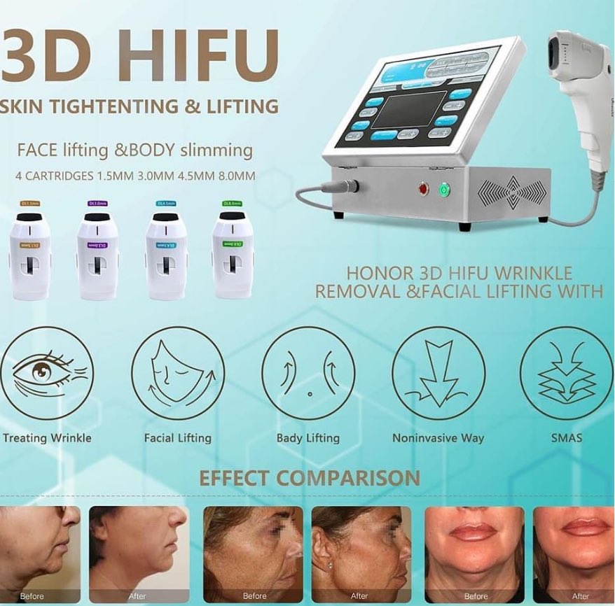 年末のプロモーション hifu 2d H2.3 ハイフ