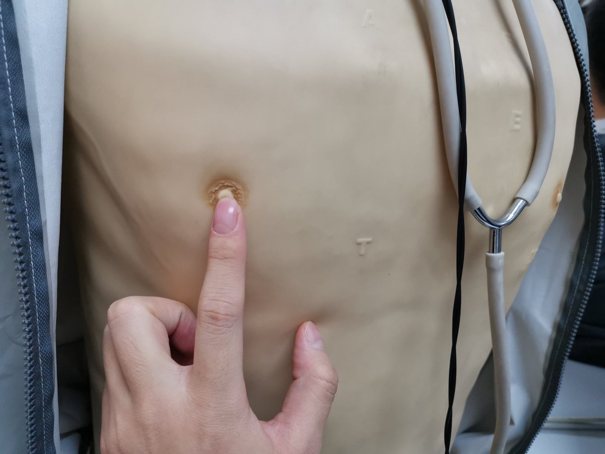 明明都有心音，他为什么不叫？