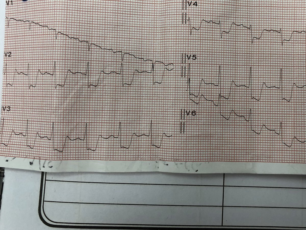 Female 20years, FHL, shocked