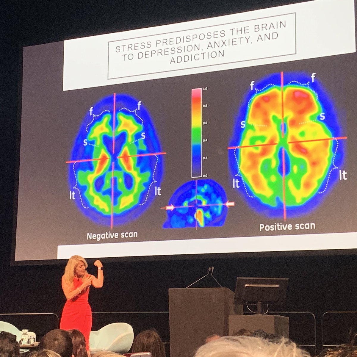 Brigid O'Connell (@brigidoconnell) on Twitter photo If you work out your biceps you see the results in the gym. The same is true for đ§ training, says Prof Selena Bartlett in her public lecture <a href="/AusNeuroSoc/">Australasian Neuroscience Society (ANS)</a>, even if you canât see changes happening. âEveryone has the ability to be the boss of their brain.â #neuroplasticity If you work out your biceps you see the results in the gym. The same is true for đ§ training, says Prof Selena Bartlett in her public lecture <a href="/AusNeuroSoc/">Australasian Neuroscience Society (ANS)</a>, even if you canât see changes happening. âEveryone has the ability to be the boss of their brain.â #neuroplasticity