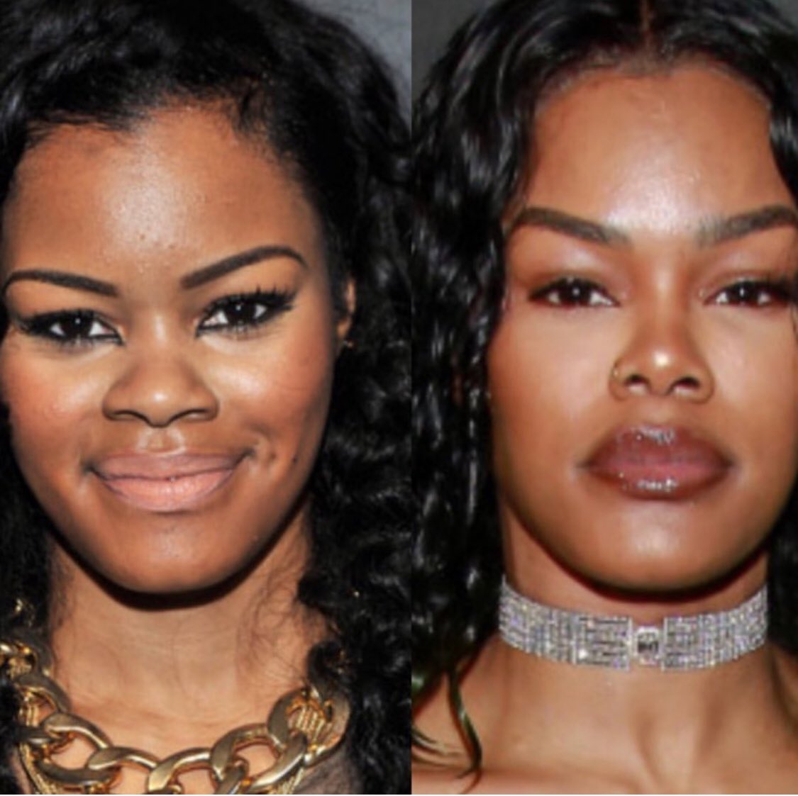 Teyana Taylor Before And After