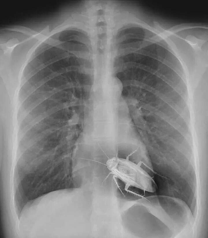 アジ 強烈な放射線を浴び続けたゴキブリは遺伝子情報が変化して殺虫剤などが効きにくくなります 一部の研究によると繁殖力は放射線 照射前のおよそ7倍 10倍 薬剤抵抗性はおよそ14倍となったそうです つまり このゴキブリが拡散すると町中がゴキブリの山