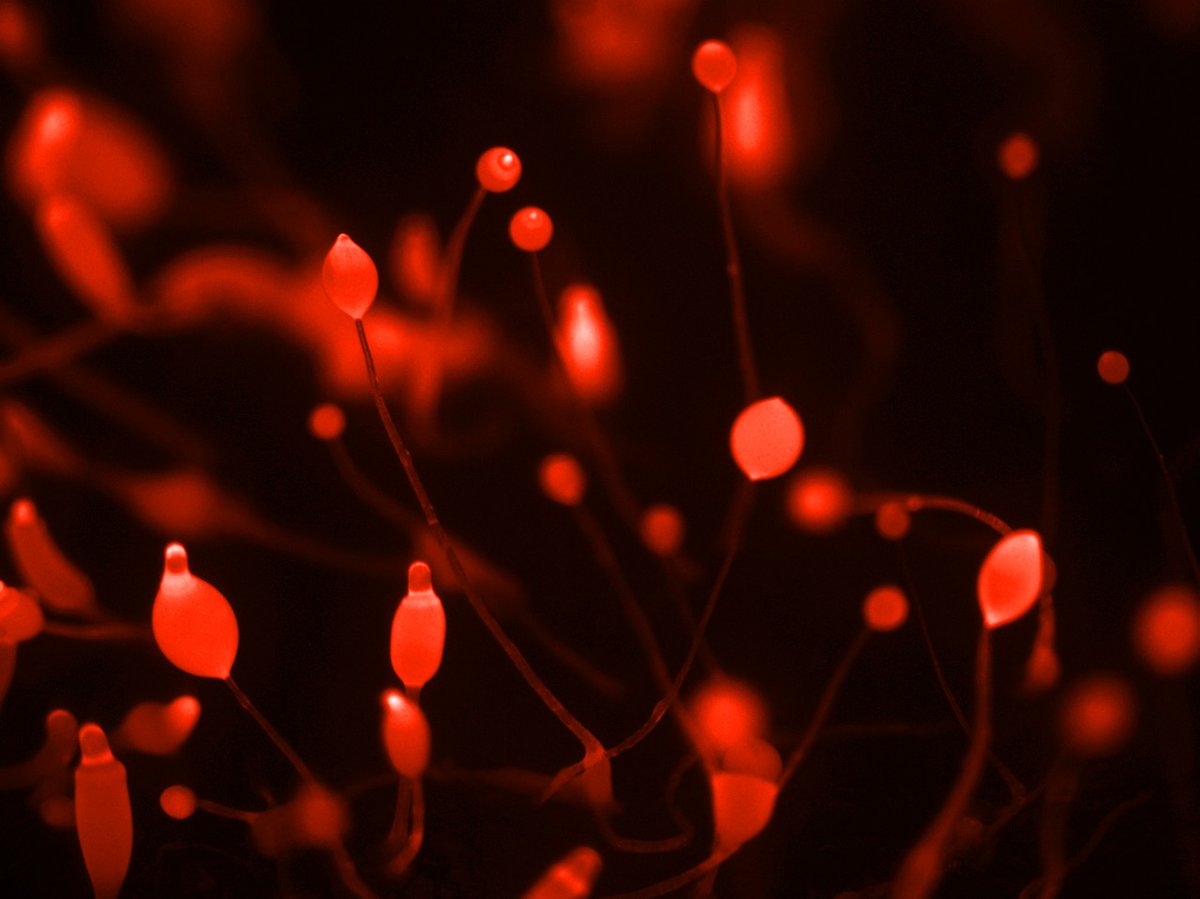 BMCBiology's tweet photo. NEW #research from @np_meena and colleagues at @NIH in Bethesda: #DPF is a cell-density sensing factor, with cell-autonomous and non-autonomous functions during #Dictyostelium growth and development 

Read more here: https://t.co/QCGWEGAfhl https://t.co/DaaXimw3dG