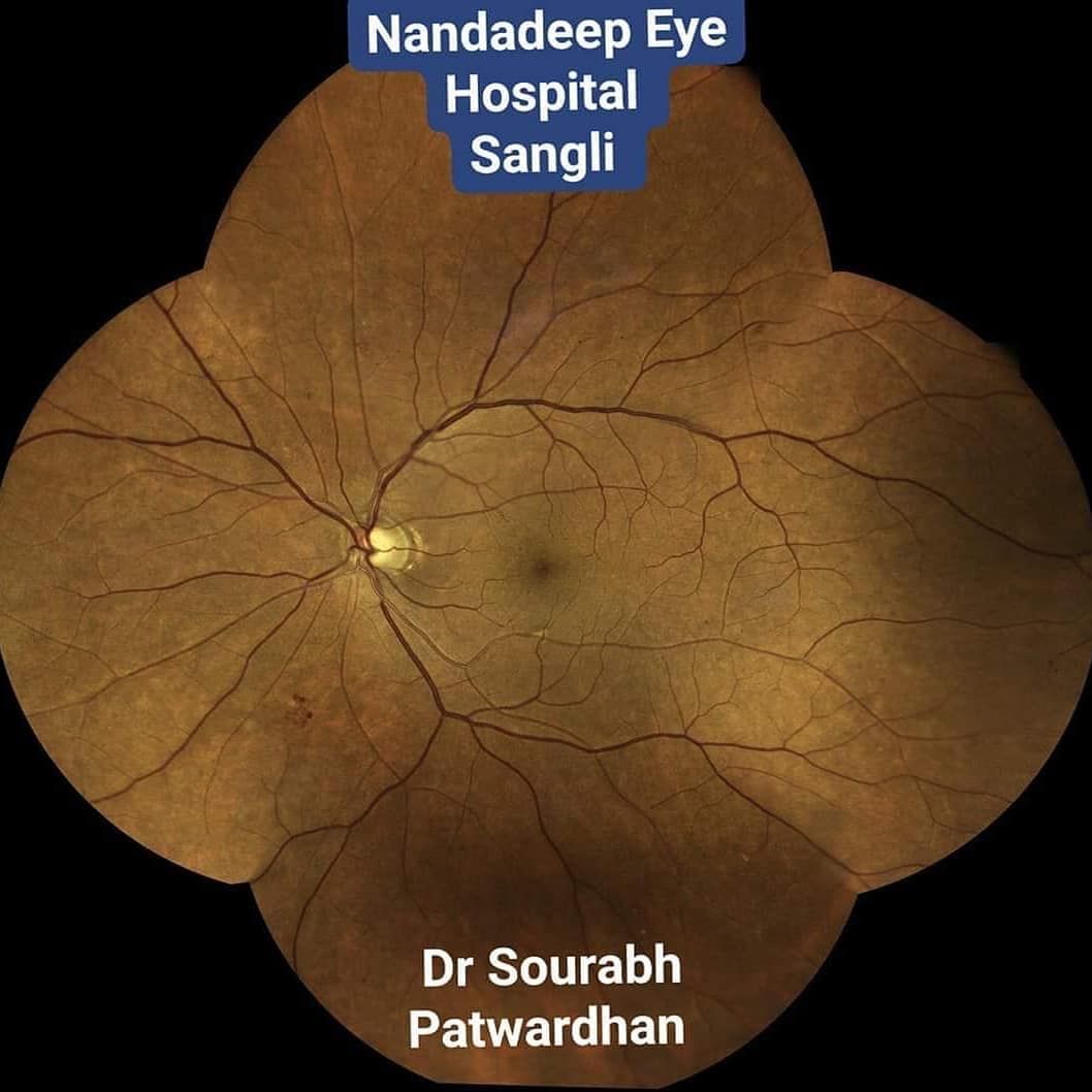 CENTERVUE tweet media