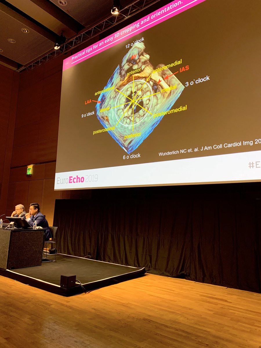 Lissa Sugeng (@sugeng_lissa) on Twitter photo Displaying the #3DEcho of MV and prosthetic MV #echofirst #EuroEcho <a href="/WilliamZoghbi/">WilliamZoghbi</a> <a href="/ASE360/">American Society of Echocardiography</a> <a href="/AddK007/">Karima Addetia</a> Displaying the #3DEcho of MV and prosthetic MV #echofirst #EuroEcho <a href="/WilliamZoghbi/">WilliamZoghbi</a> <a href="/ASE360/">American Society of Echocardiography</a> <a href="/AddK007/">Karima Addetia</a>