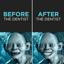 SyzeUKStore's tweet photo. Before and after the dentist
#dental #dentist #dentalhealth #dentalcare https://t.co/9qVE2chddV