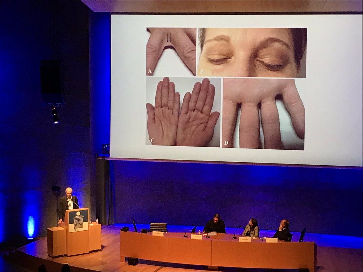 unainternista's tweet photo. Claves para la resolución de casos complejos en #lipidologíaclínica
Dr @FernandoCiveir1 nos insta a:
- anamnesis detallada
- exploración física #minuciosa
- historia familiar detallada
*Descartar causas de dislipemia secundaria/fármacos
#fipec19 #fipec2019
@DaianaIbarretxe https://t.co/hBRZwRWWlu