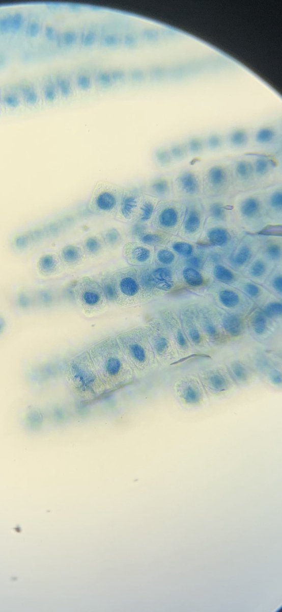 Beautiful garlic root tip slide, showing cells at various stages of mitosis from my HNC Applied Science group #moresuccessfulstudents #DA_STEM