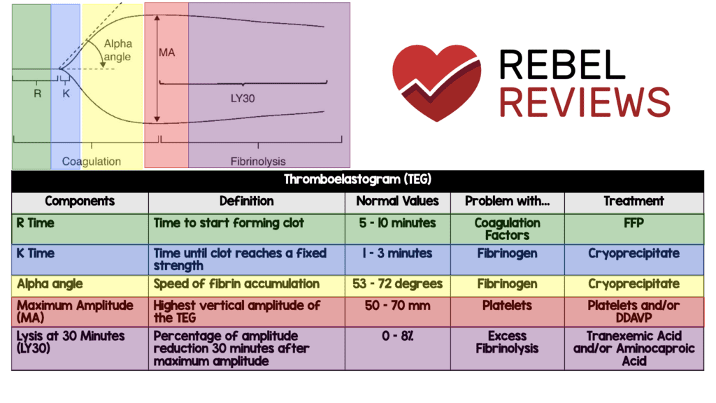 EMSwami's tweet photo. Grand Rounds @HumanFact0rz TEG/ROTEM in trauma
Clotting time prolonged = plasma
Angle (fibrin issue) = cryo
Max Amplitude = platelets/DDAVP
LY30% (excess fibrinolysis) = TXA https://t.co/zxVNIxnFdA