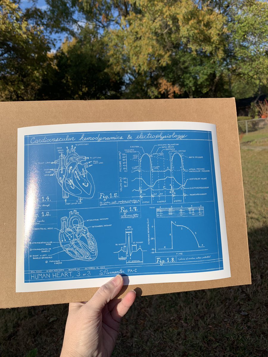 Love my print! (Blueprint)
💙💙💙💙
@bodyblueprintsart @EPLabDigest @CathLabDigest #cardiacimaging 
#actionpotential #electrophysiology #nurselife #wiggersdiagram