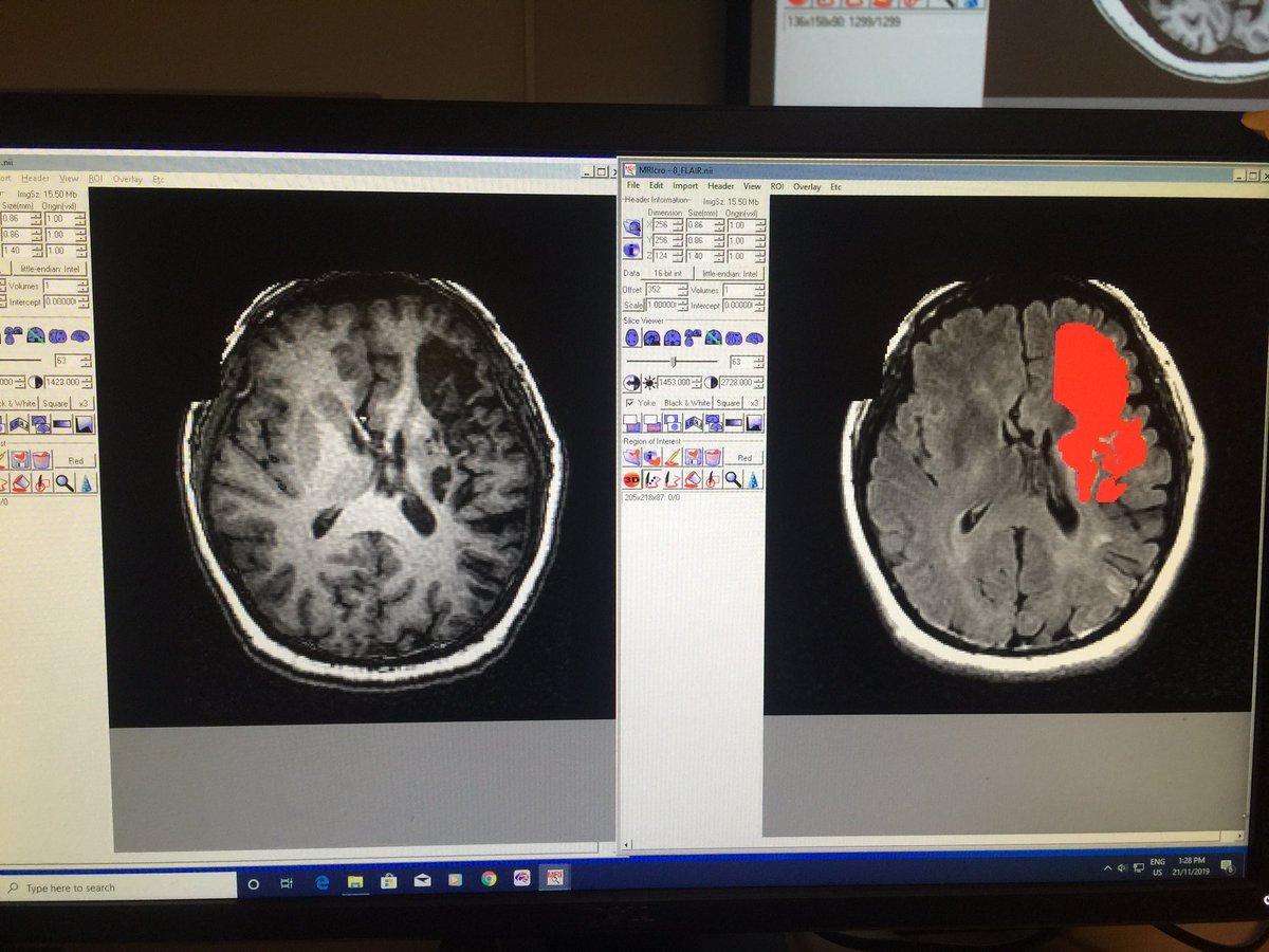 sarahpaark's tweet photo. DAY 3 of @HSFCSR #SPiN2019 (yesterday) Part 1: arrived at @Sunnybrook, had a great talk by Dr. Rick Swartz, visited various labs like Drs. Aubert, McLaurin, Stefanovic, learned how to locate strokes on MRIs with Dr. Sandra Black’s lab... https://t.co/d8tS3IqdHM