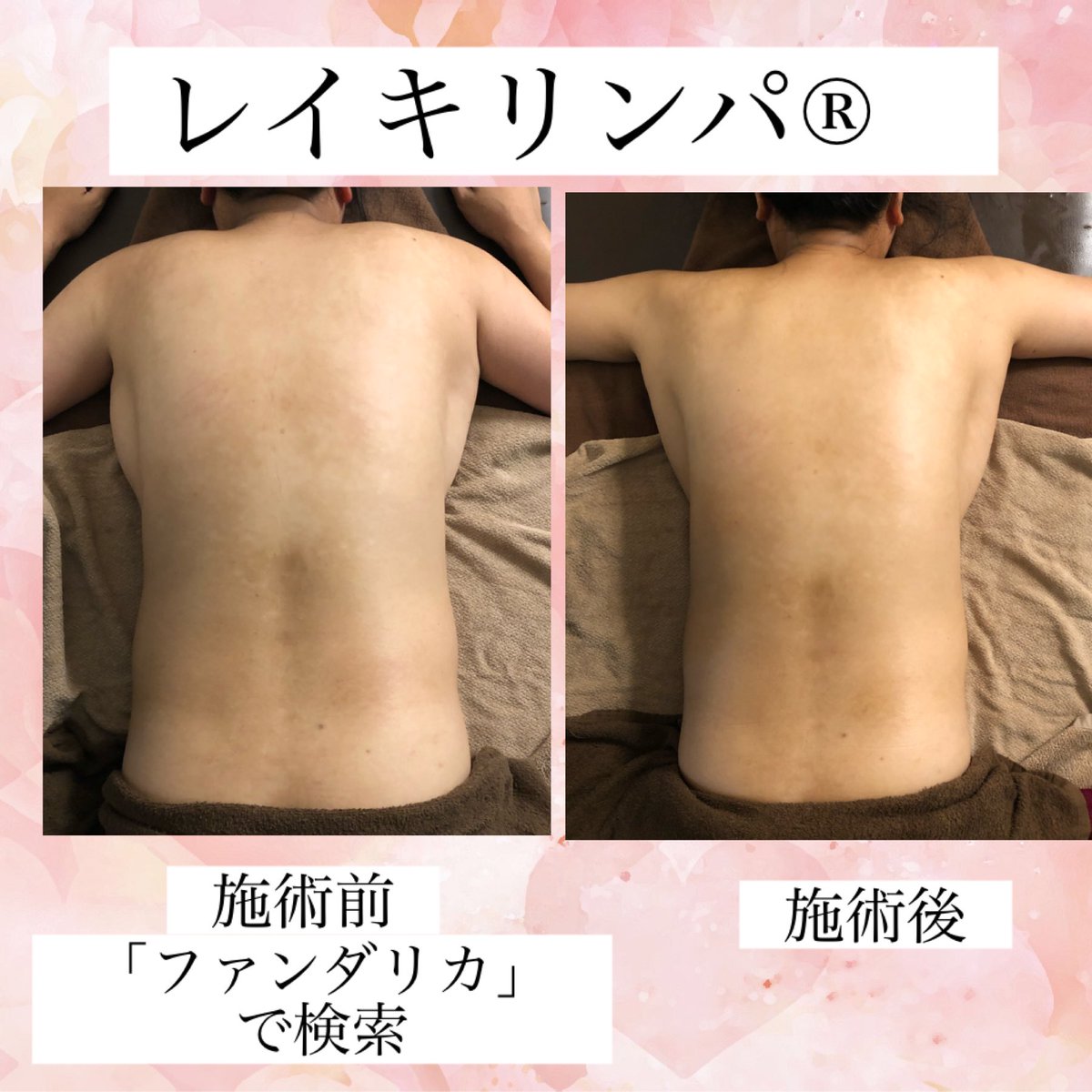 レイキリンパ Twitter Search Twitter