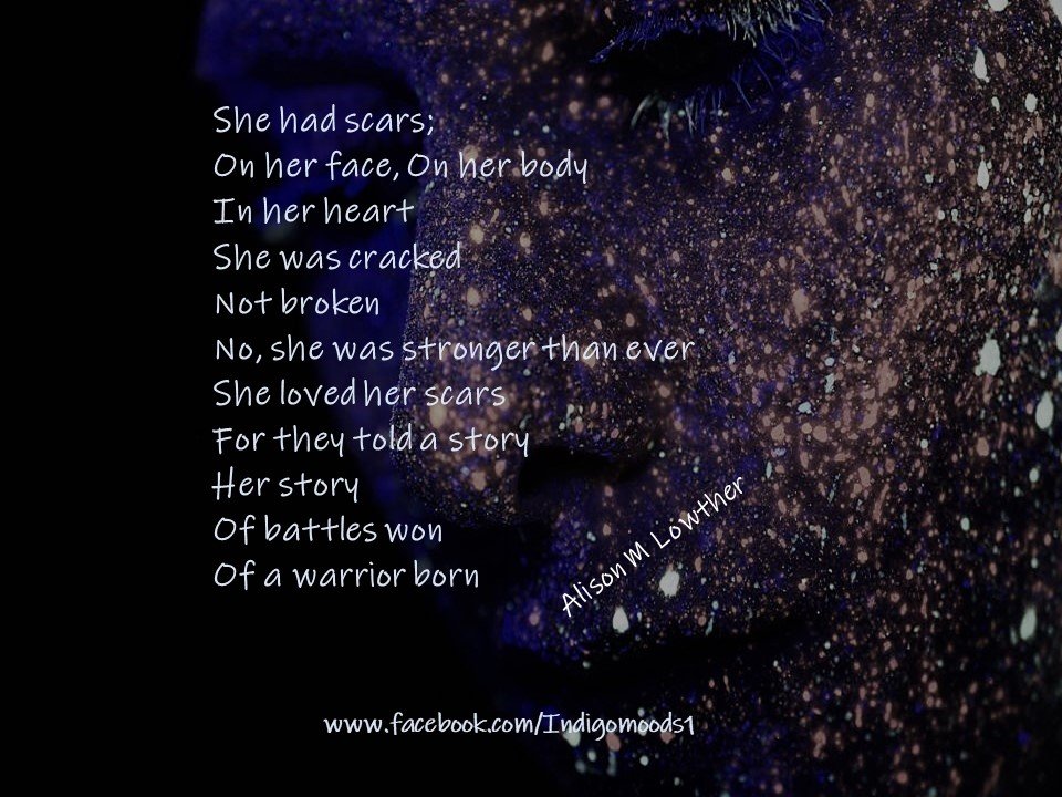 Scars #poetry #poetrycommunity #poetrylovers #poetrywriter #POEMS #PoemADay #poem #poets #poetsofinstagram #writers #poemsaboutlife #quotes #lifequotes #depression #anxiety #DepressionIsReal #strongwoman #EmpowerYourBelief #quotesaboutlife #quotes