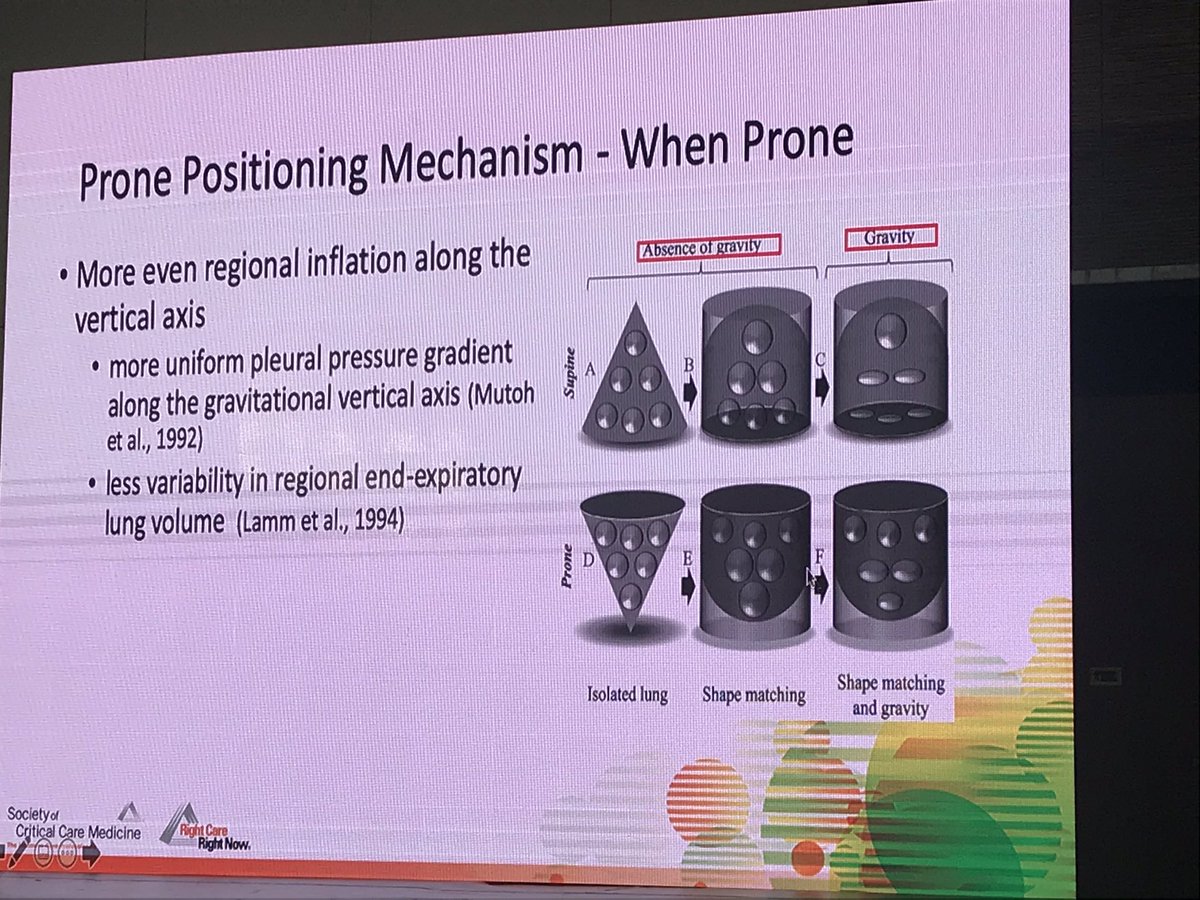 Great slides from  @maq_curley presented by  @ICheifetz showing prone positioning impact on  #lung, adult evidence &  #pedsicu considerations.  #BestofSCCM 