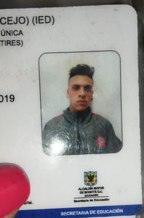 ElJuliSastoque's tweet photo. Él es Dylan, un joven como muchos de nosotros lleno de sueños y decidió marchar con la esperanza de que ser escuchado por el Gobierno; es estudiante y menor.

Pero lo que recibió fue un disparo en la cabeza con una aturdidora.

Se metieron con la generación equivocada, @IvanDuque https://t.co/xZ2Rsx0LnX