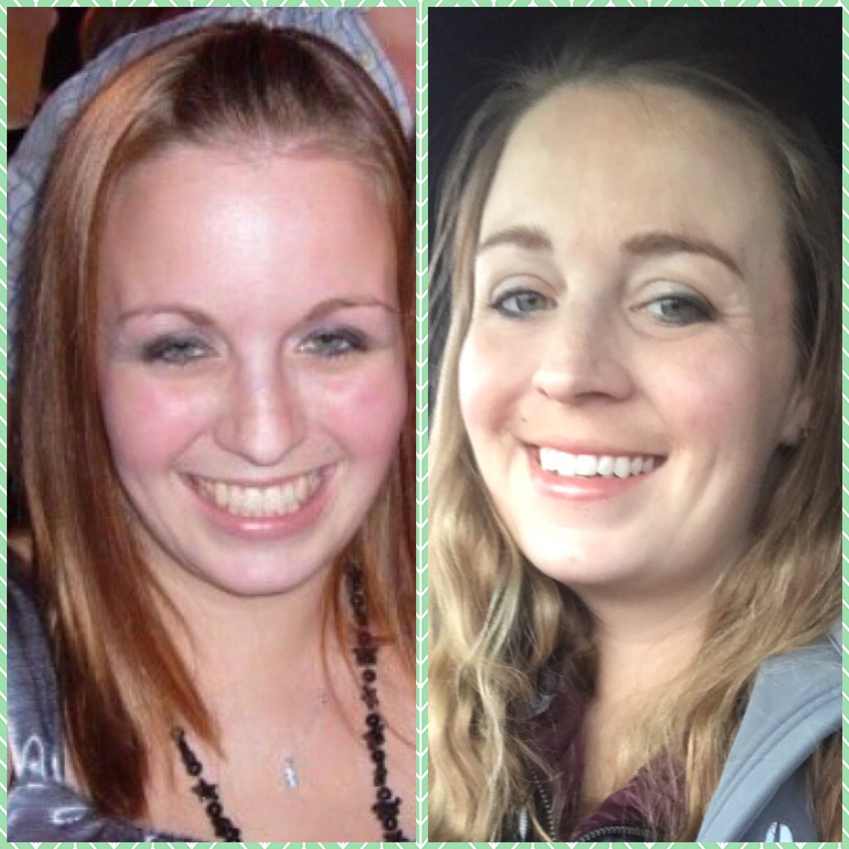 _MG42's tweet photo. #TenYearChallenge 2009vs2019
The things I wish I could tell the girl on the left 💋#thoseBrows https://t.co/ahcCLyiGca