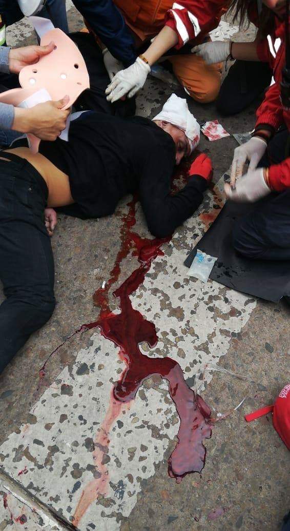 danovislozano's tweet image. #TodosSomosDylan
Él es Dylan, un joven como muchos de nosotros lleno de sueños y decidió marchar con la esperanza de que ser escuchado por el Gobierno es estudiante y menor
Pero lo que recibió fue un disparo en la cabeza con una aturdidora
Se metieron con la generación equivocada