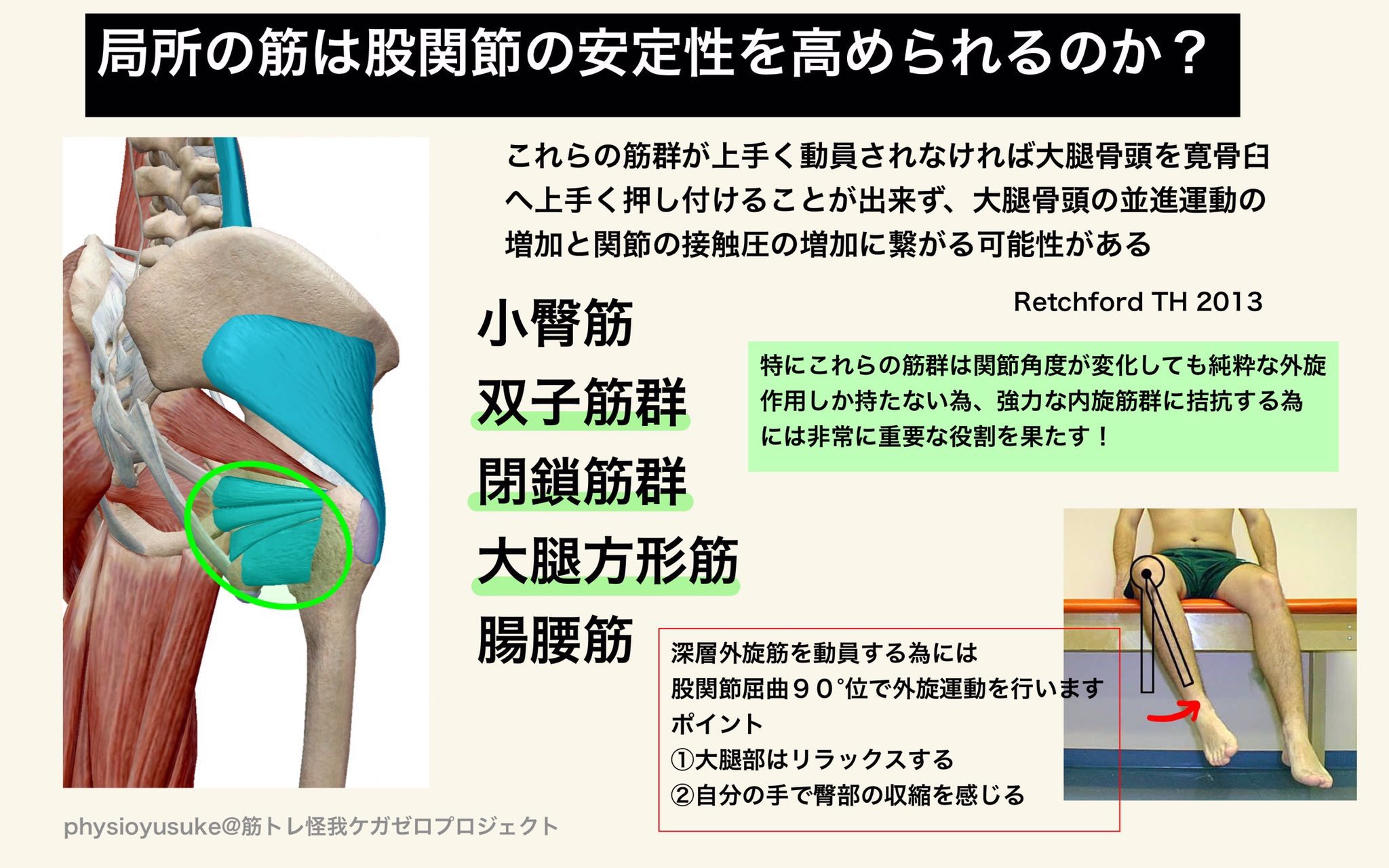 ユウスケ 筋トレ怪我ケガゼロプロジェクト Ar Twitter 深さと股関節 ローバースクワットで重要な 股関節の屈曲 不足するとボトムでの股関節インピンジメントや腰椎の不安定性に影響します 大腿骨の構造的特徴である 大腿骨後捻 の場合には股関節を外転外