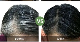Permanent Hair Remov on Twitter: Permanent Hair Remov on Twitter: