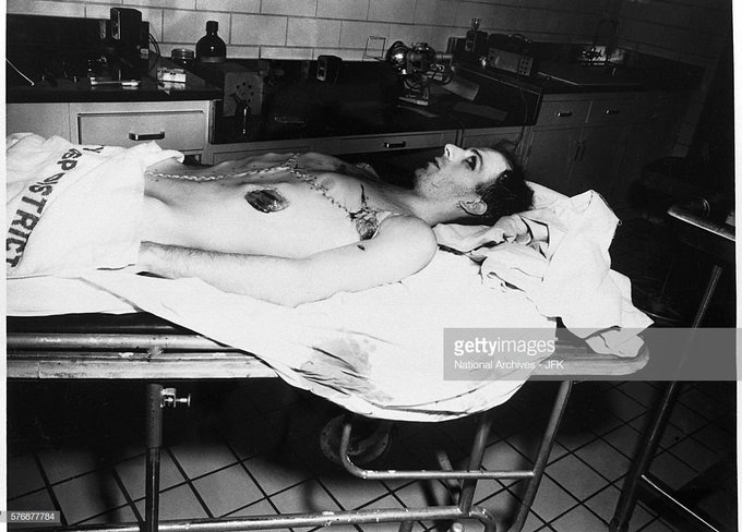 Lee Harvey Oswald after autopsy. 