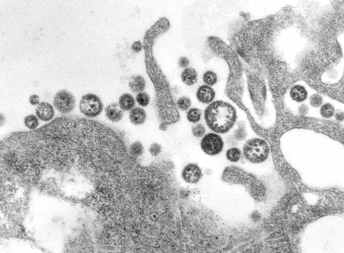 rivm's tweet photo. De tropenarts die enkele dagen geleden met lassakoorts was opgenomen, is gisteravond overleden. Zijn directe collega is inmiddels ook gerepatrieerd. https://t.co/roRX5lktkq https://t.co/RSf0wMkr3y
