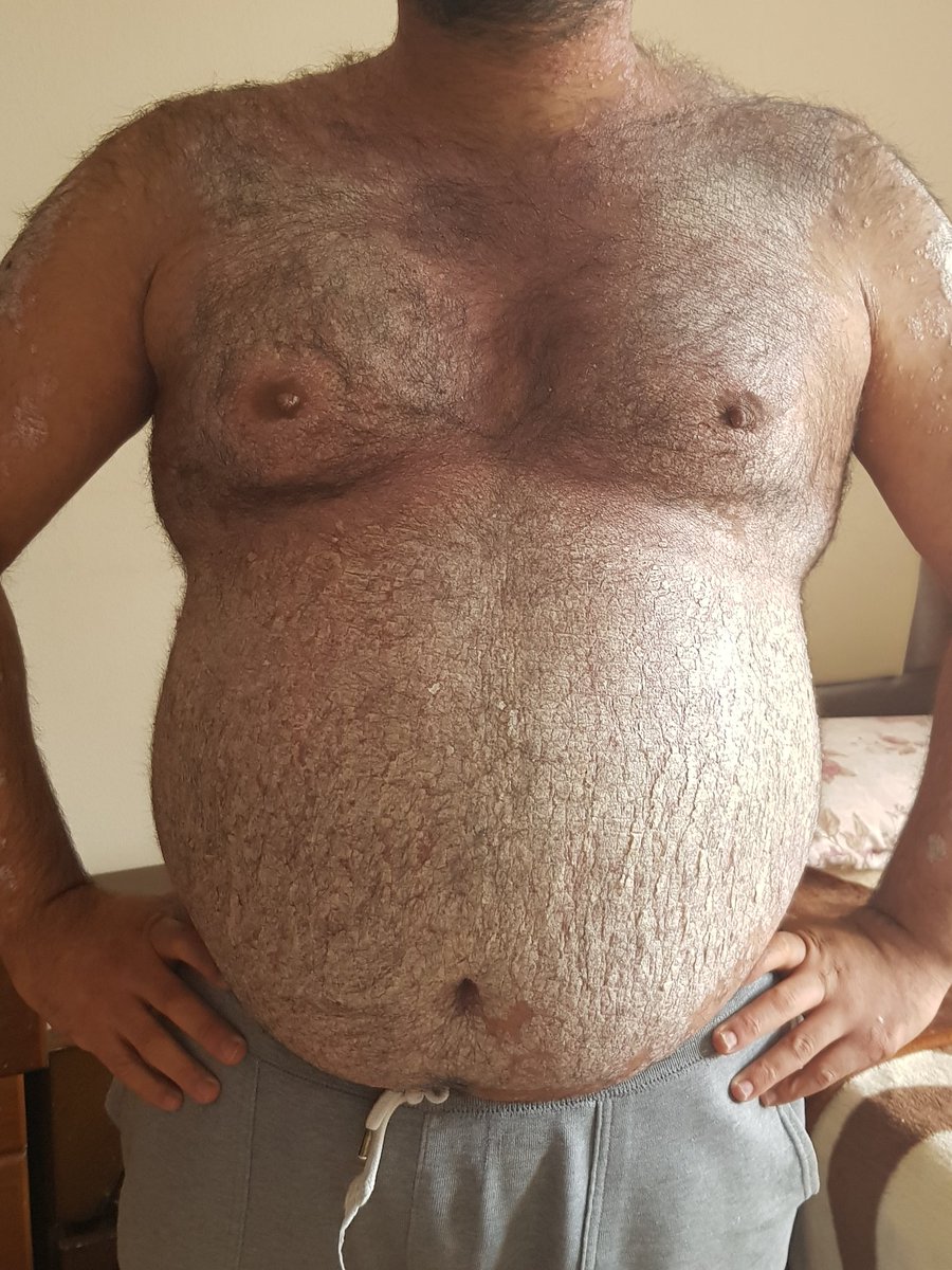 Bunları paylaştığım için çok üzgüm başka çarem olmadığı için ben de istemezdim öyle olmazsını bir umut arıyorum.