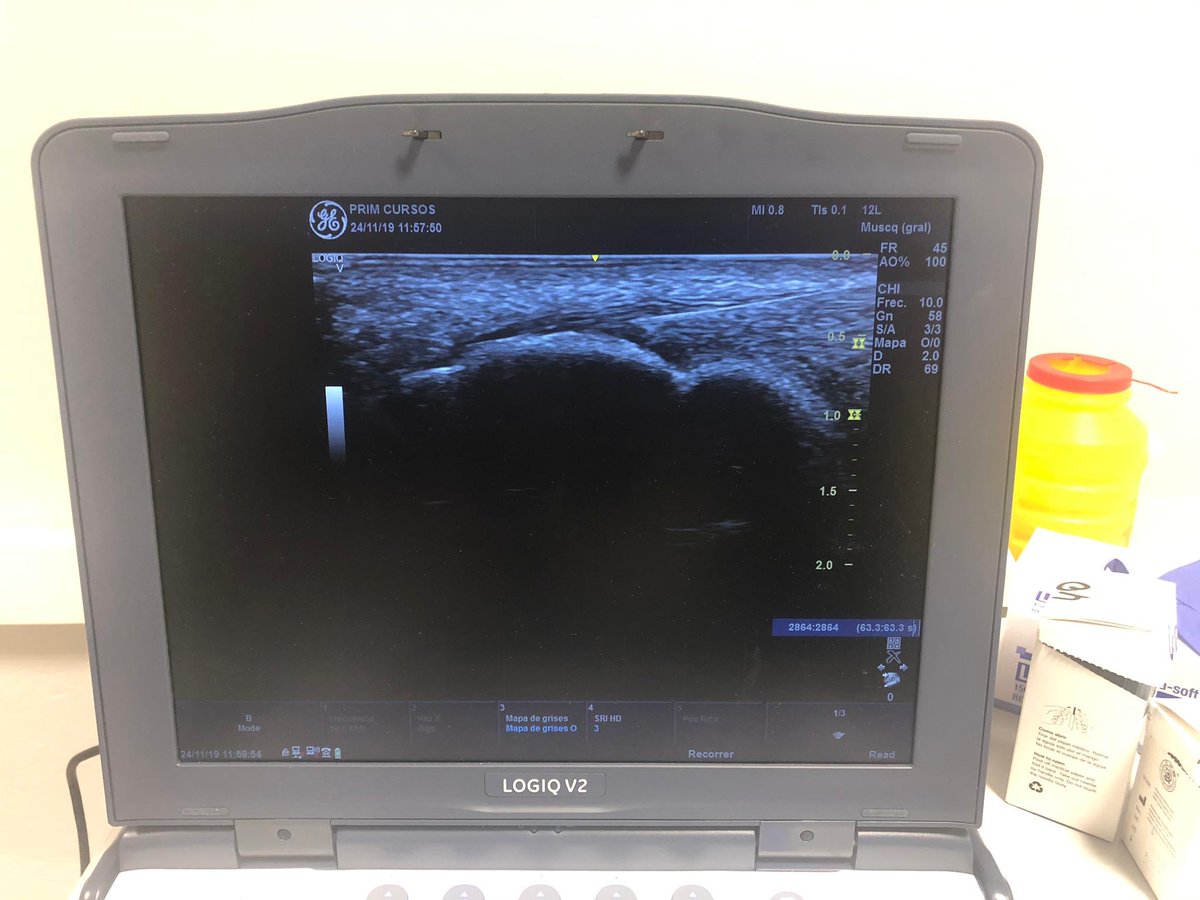 Electr. Percutánea tweet media