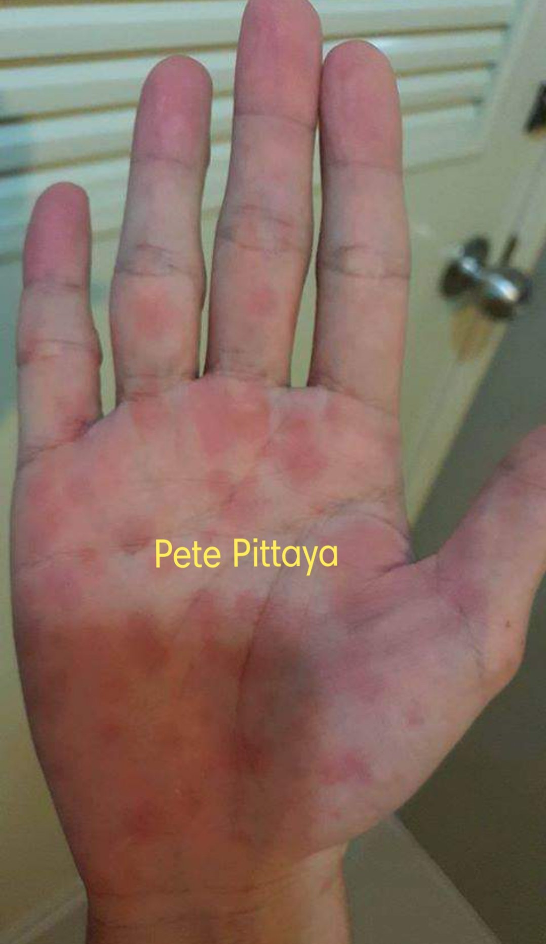 Pete Pittaya On Twitter: 