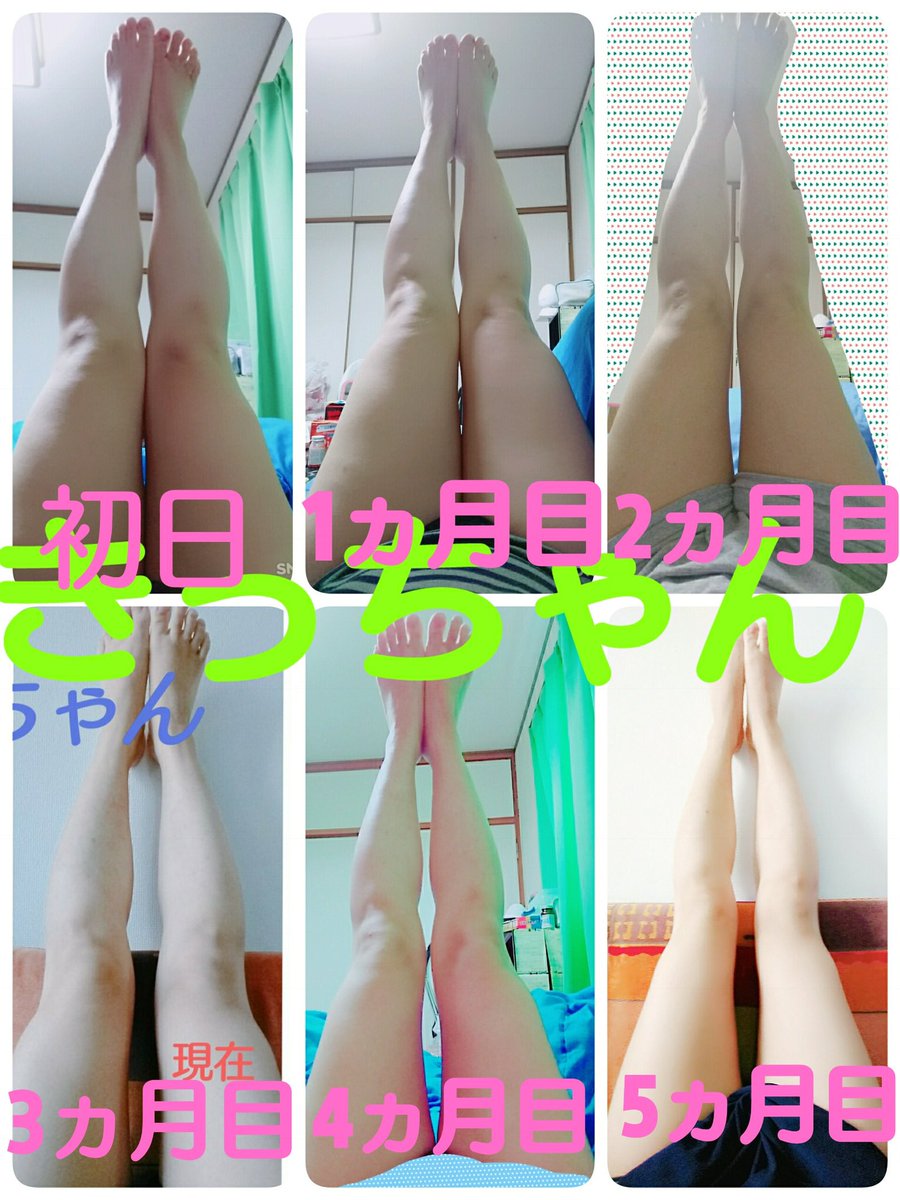 きっちゃん 24 達成 定期的にくる脚痩せの方法について 個人的に脚だけ痩せるなどの部分痩せ 脂肪を落とす は出来ないと思っています 細くするならまず痩せる とにかく歩く ストレッチマッサージやる 浮腫み対策徹底 水分塩分の見直し それから筋