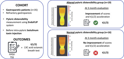 Check out this new study by Desprez et al, “Pyloric distensibility measurement predicts symptomatic response to intrapyloric botulinum toxin injection.” ow.ly/CtzL30pO131